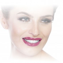 Braquete Estético de Safira Roth PolySafira - 21 - 10.24.002 -Morelli